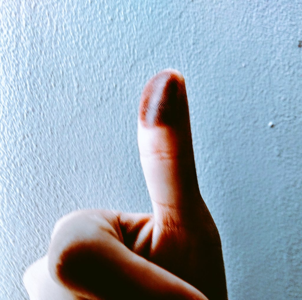 iquechocosa's tweet photo. Llego la hora de salir a votar, no te vendas¡!#eleccionesedomex2017 #PriNo #PRImierda Dale un madrazo a del Mazo. 😕 https://t.co/VdTXoWs5gK