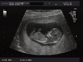 DartsbbJacks's tweet photo. Congratulations @welchyyyy always knew you'd be the first 👶🏼 https://t.co/F7qtUGqrxh