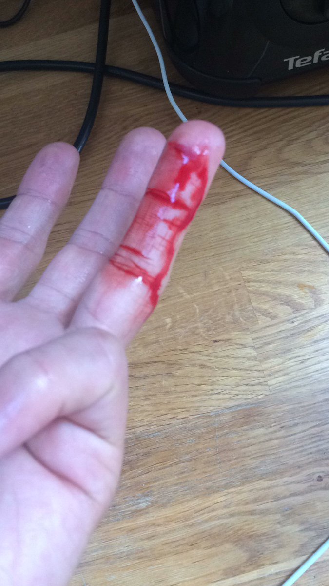 theturnertwins's tweet image. Not the most efficient #BBQ this evening. Any fire lighting tips @BearGrylls? 🤕 #survivalskills #noplasters