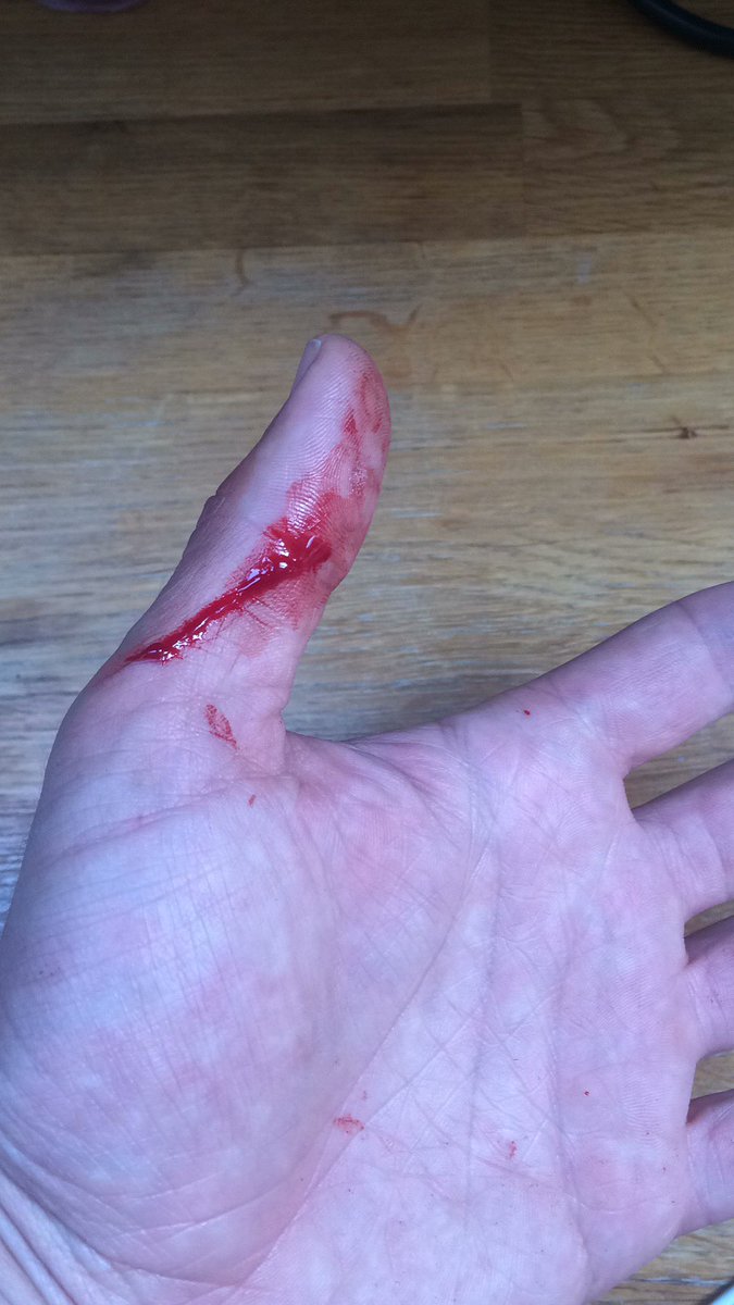 theturnertwins's tweet image. Not the most efficient #BBQ this evening. Any fire lighting tips @BearGrylls? 🤕 #survivalskills #noplasters