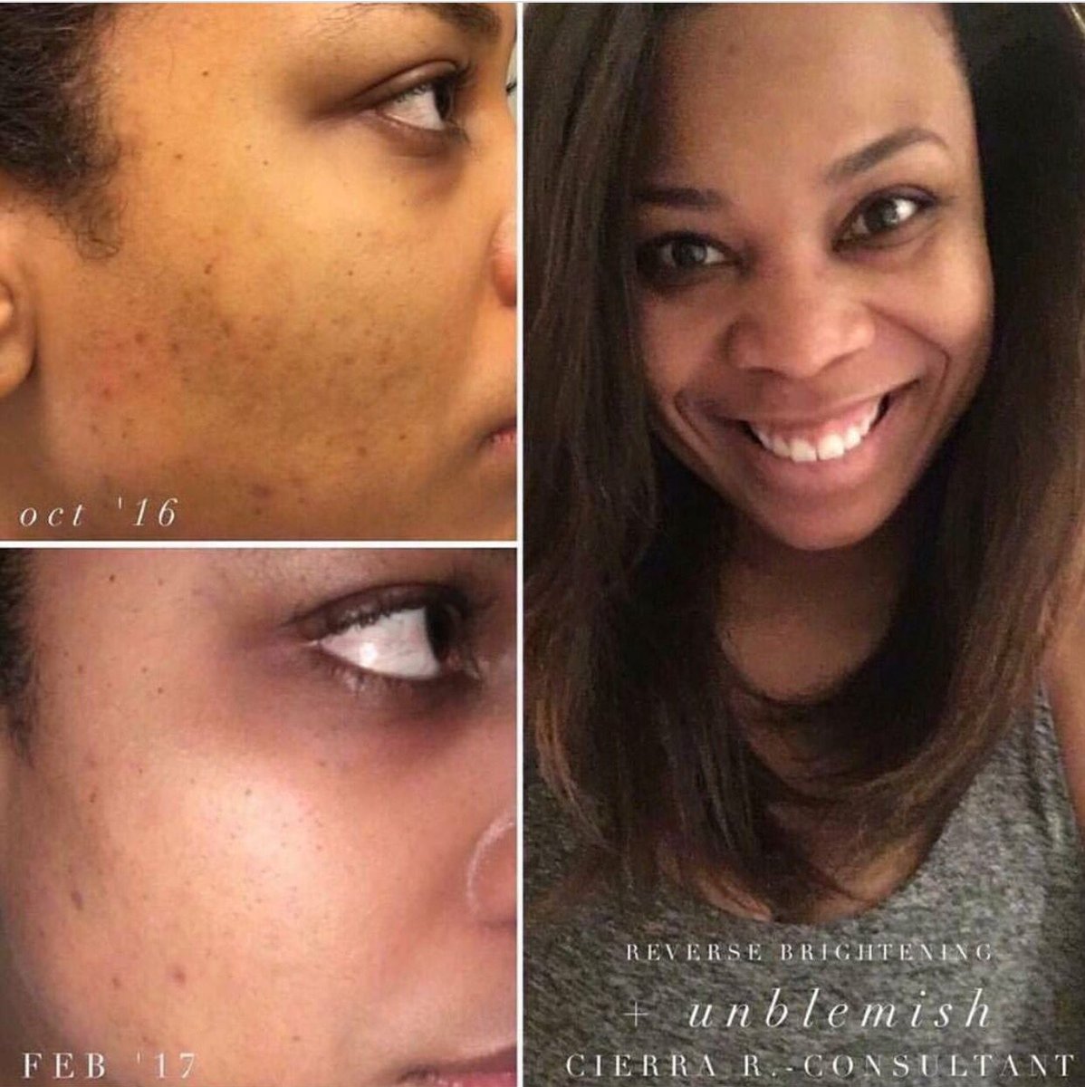RyanInMiddle's tweet image. Her smile says it all. #byebyeacne #60daymoneybackguarantee
buff.ly/2s72LG0