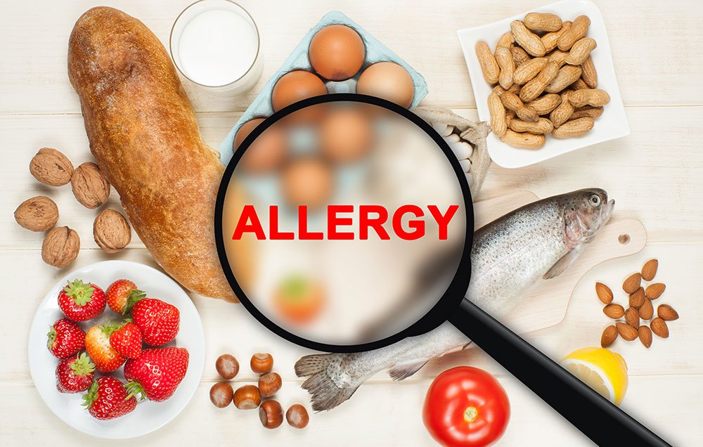 2chicksplan's tweet photo. 8 Most Common Food Allergies, Explained
https://t.co/j4ZRNYUseN https://t.co/gIMYN8Wtcq