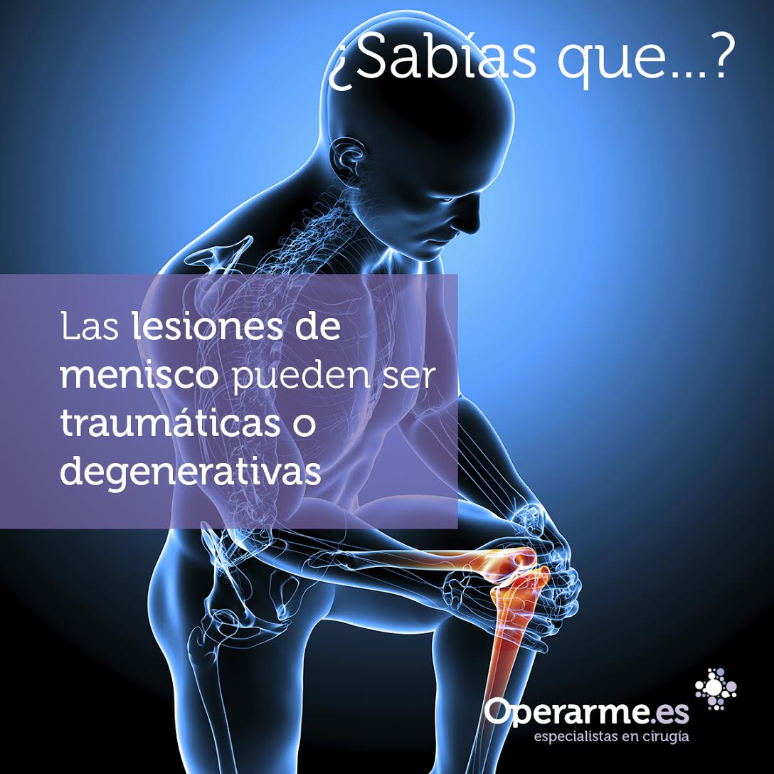 Operarme's tweet photo. #LesiónDeMenisco #EspecialistasCirugía https://t.co/qR5LdBuZtZ