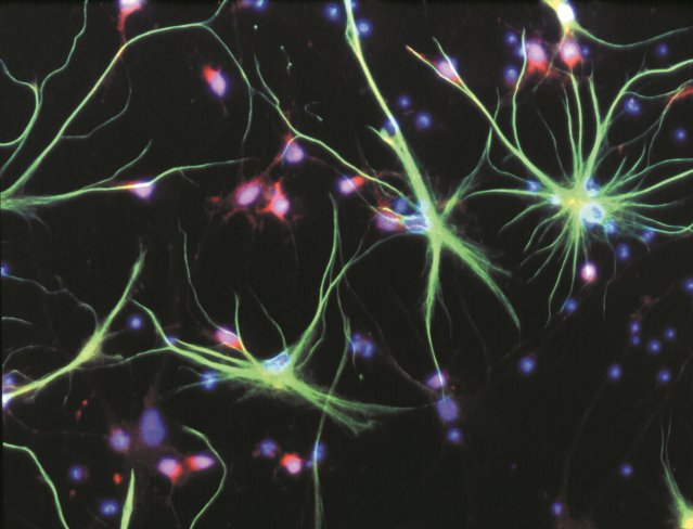 SpinalResearch's tweet photo. Neuropathic pain is very debilitating in SCI. Find out about, and support, our research for a non-invasive treatment https://t.co/LLaA76Hxnn https://t.co/103zTkbAkS