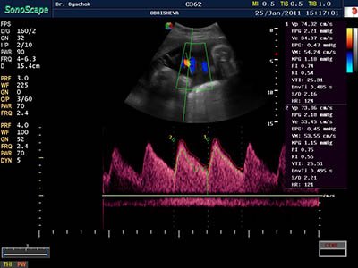 Servimedical17's tweet photo. #S8Exp #SonoScape #Servimedical ofrece una solución ecográfica portátil eficiente, superior, con clase y desempeño.
https://t.co/p7eeq87adZ https://t.co/sGj6aNJyv6