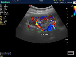 Servimedical17's tweet photo. #S8Exp #SonoScape #Servimedical ofrece una solución ecográfica portátil eficiente, superior, con clase y desempeño.
https://t.co/p7eeq87adZ https://t.co/sGj6aNJyv6