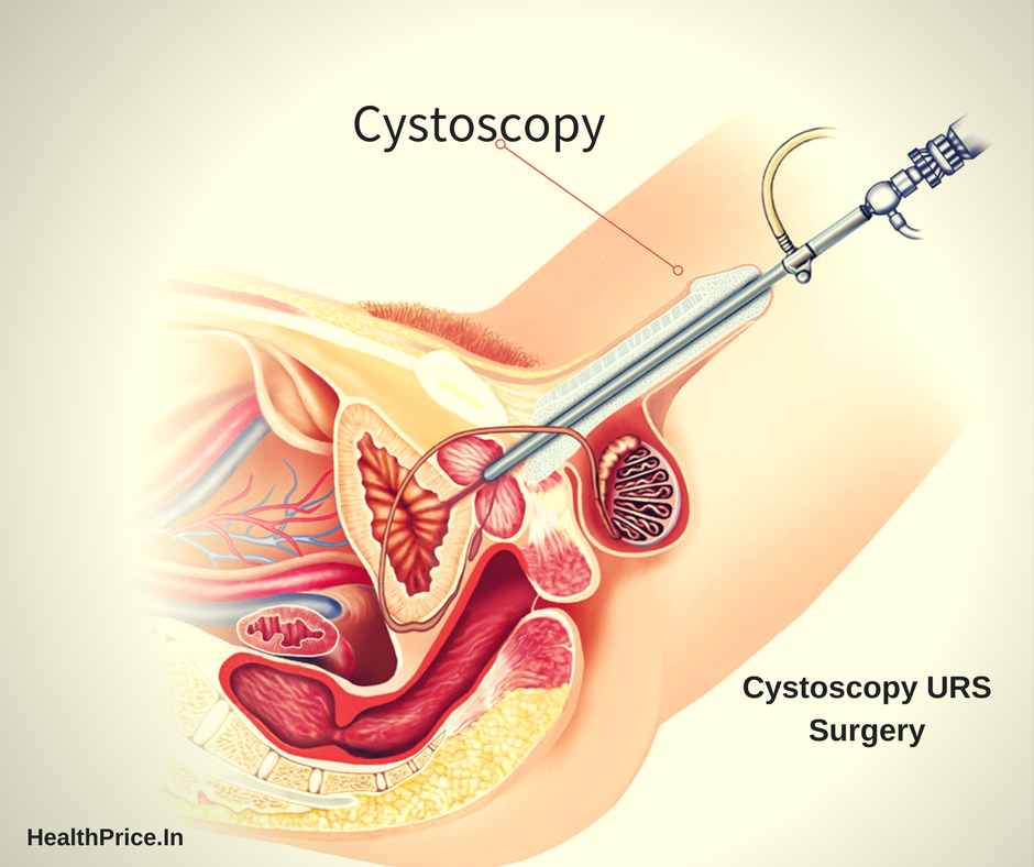 Ozut_com's tweet photo. Do you know what is #Cystoscopy ?
https://t.co/TX9HZLuVND https://t.co/aqpejJvxHE