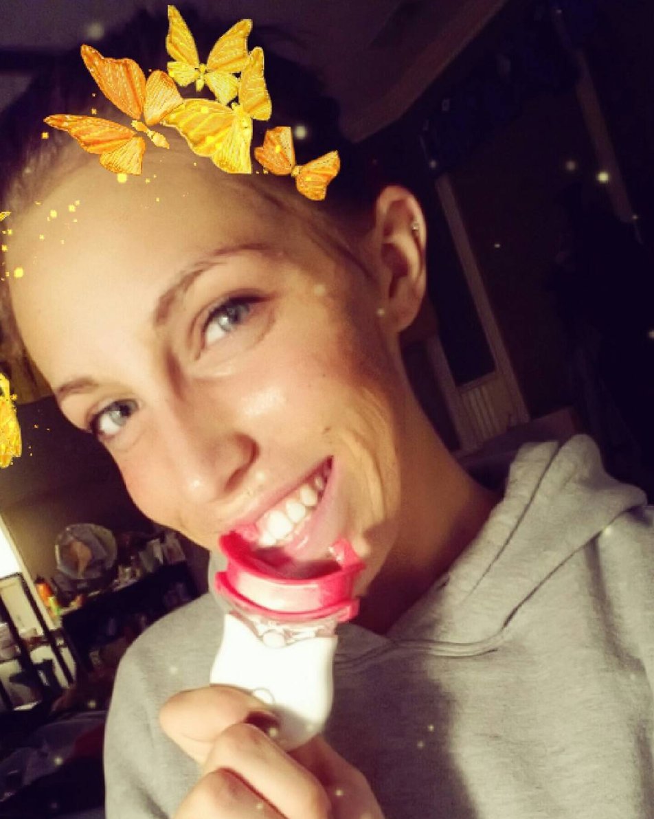 AsproBright's tweet photo. katellyn padgett Using #TwilightTeeth, Aspro Bright uses the same great formula! #WhiteTeeth #TeethWhitening #Smile
https://t.co/KVmww6rmsO https://t.co/nYZmkKpIdp