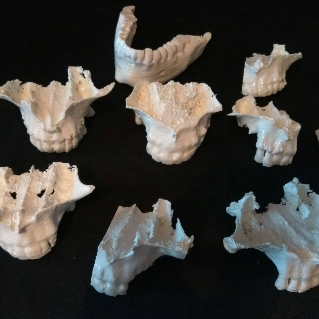 New #3dmodels for #maxilofacialsurgery . Nuevos modelos #3D para #maxilofacial #surgery #3dprinting
