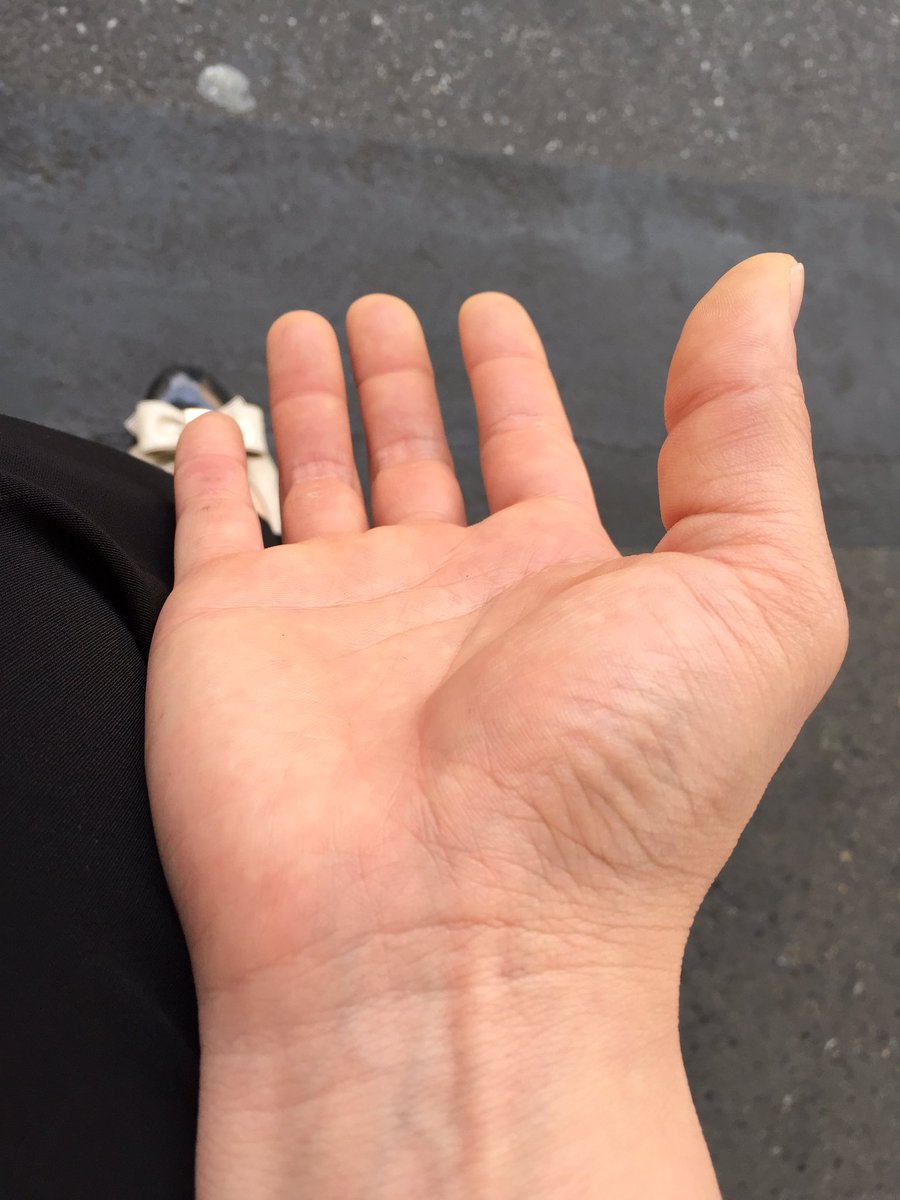 大嶋あやの A Twitter 店長から親指腫れてんぞ て言われたけど 実はこれ 母指内転筋という筋肉なのです