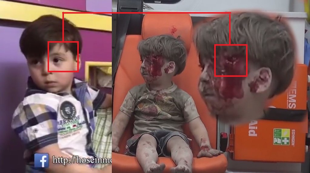teo_dorakis's tweet photo. Omran Daqneesh'in ailesi ortaya çıkınca,
#TheWhiteHelmets'in dünyaya servis ettiği yara makyajlı "Omran bebek" yalanı da ortaya çıktı.! https://t.co/9PmSETt7nK