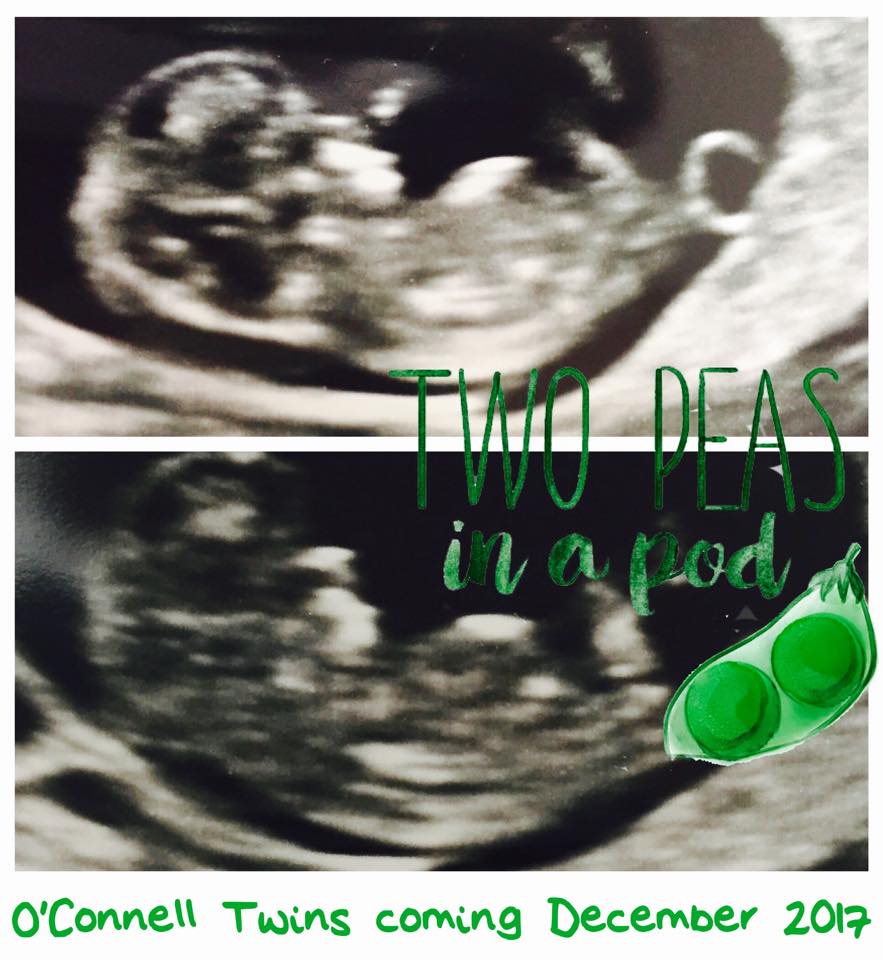 BrodyOConnell's tweet photo. Coming out of Twitter retirement with #Breaking News!!!!! #Twins!!! Kate and I are very, very excited. #Blessed #zerosleepahead https://t.co/uf3XQIyNIQ