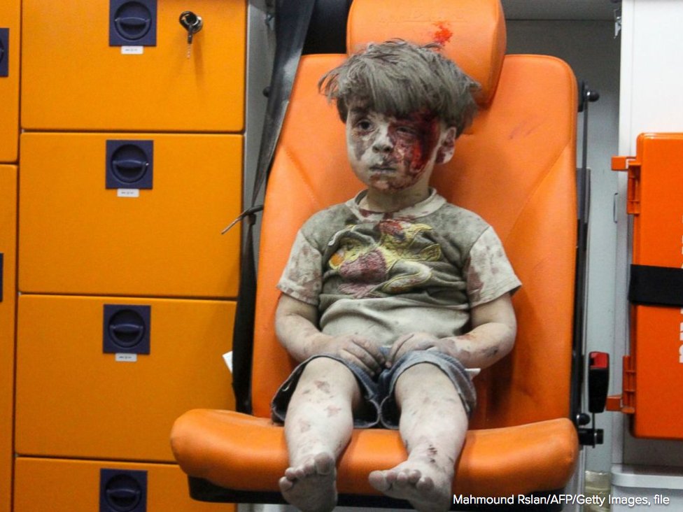 moonchildandsun's tweet photo. ภาพปัจจุบันของน้อง Omran ที่คนให้เป็นภาพสัญลักษณ์ของสงครามที่ Aleppo เมื่อสิงหาคม 2016   ปัจจุบันน้องสบายดีและยังอยู่กับครอบครัวค่ะ https://t.co/Mp3HO39CHc