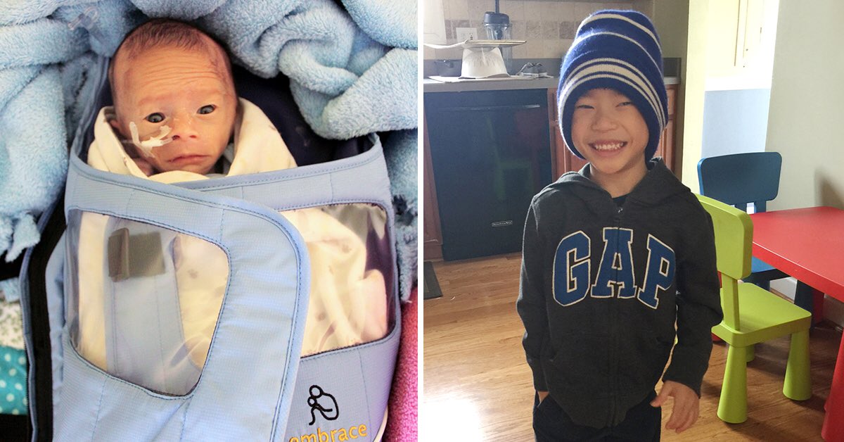 Nathan was helped by our Embrace warmer in China &amp; now lives in Chicago! Read more: littlelotusbaby.com/blogs/news