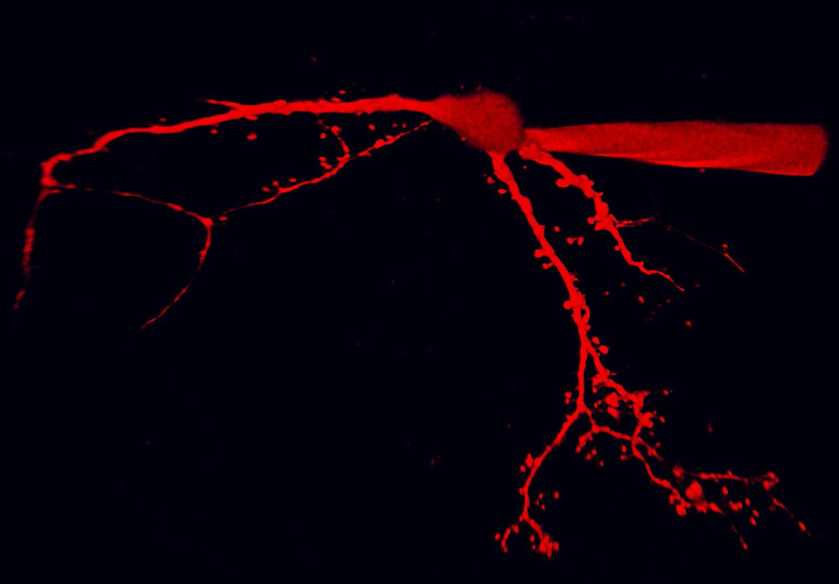 ek_harding's tweet photo. Spinal cord #neuron recording #ephys #dendrite #dendriticspine https://t.co/jMwXRQ6ckA
