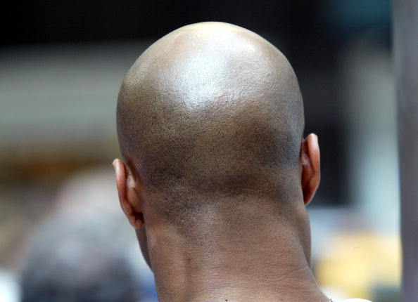 BBCAfrica's tweet photo. Mozambique police warn bald men they could be the targets of ritual attacks, after two of them were killed https://t.co/qoCvx9rhsS https://t.co/4quYCorgVw