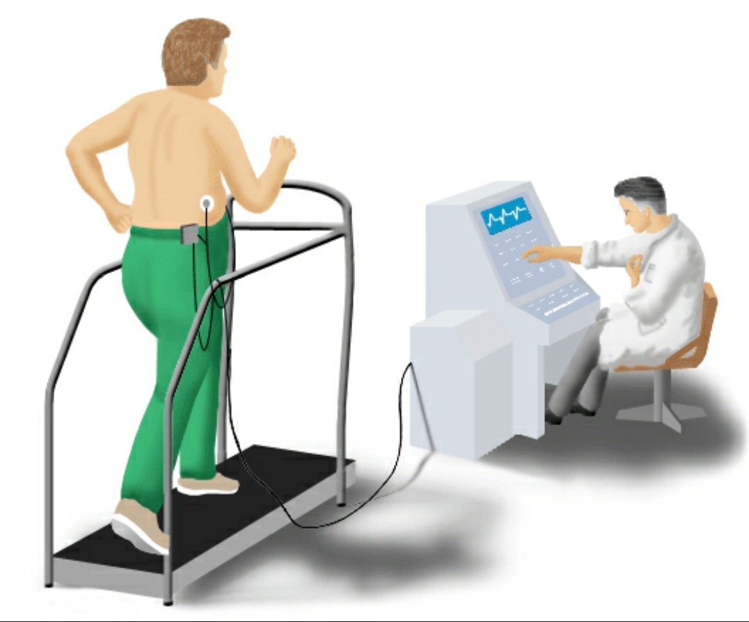 Javier Elorrieta, nos comenta que debemos hacer para realizar una prueba de esfuerzo, llama a  987070719 y te informan .<a href="/JpElorrieta/">Fisioclinicas</a>