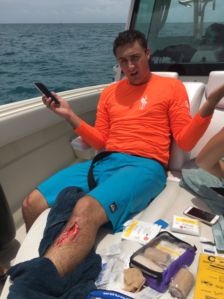 ParketSimon's tweet photo. The short clip of me getting attacked by a 7-8ft reef shark. 
https://t.co/OGP7z6CUXd https://t.co/cMYb7OpDSt