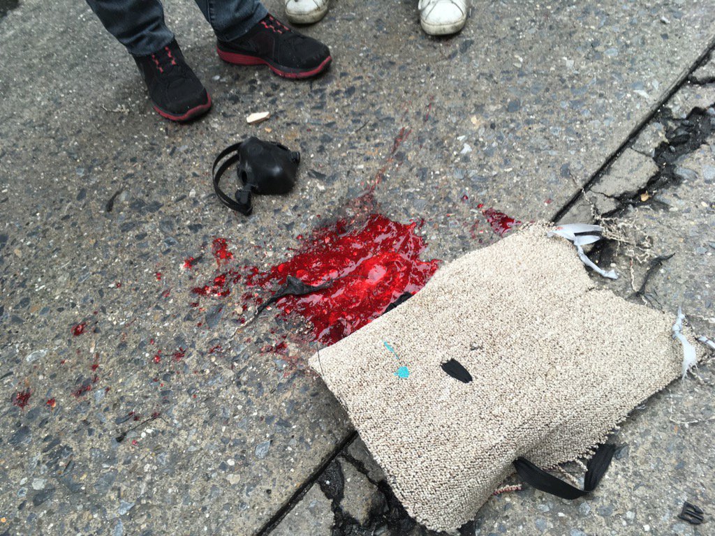 Sangre de joven herido en la Av. Libertador. Fue trasladado a la clínica Ávila con impacto en el pecho 4:30pm