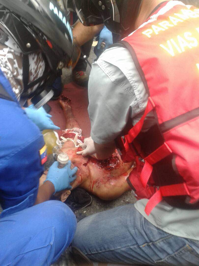 ErikaOSanoja's tweet photo. Fotos atribuidas al joven Neomar Lander. (Atención: gráficas explícitas). Versión opositora: «lacrimógena» Extraoficial: manipulaba mortero. https://t.co/s5udmlzSfP