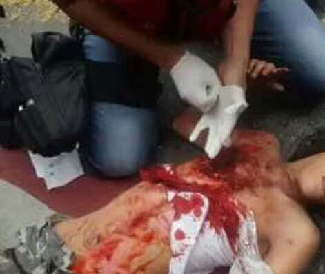 ErikaOSanoja's tweet photo. Fotos atribuidas al joven Neomar Lander. (Atención: gráficas explícitas). Versión opositora: «lacrimógena» Extraoficial: manipulaba mortero. https://t.co/s5udmlzSfP