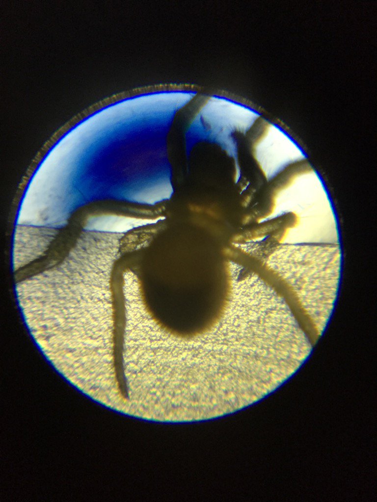 Isabelle Girard Bebe Araignee Observee Au Microscope De Ma Fille X100