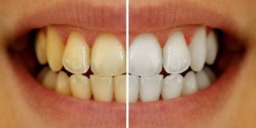 orbellmx's tweet photo. La diferencia entre recibir un beso y quedarte con las ganas..blanquea tus dientes naturalmente #shoponline https://t.co/XxvWYx1jBB #orbell https://t.co/PnTbnKmvZ3