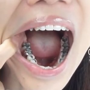 dental_gravity's tweet photo. 最強 https://t.co/Cbg0yFQtzu
