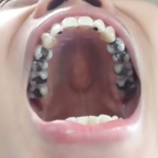dental_gravity's tweet photo. 最強 https://t.co/Cbg0yFQtzu
