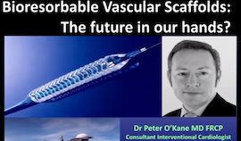 EducationSimple's tweet image. This free webinar explores what we have learnt in the 10 yrs since #BVS were implanted in human #coronary #arteries 
simpleeducation.co/moments/119