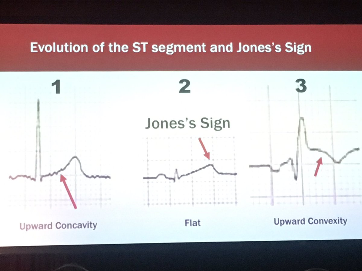DocBrants's tweet photo. dr Jones explains #DEMC17 https://t.co/Z5x31omstC