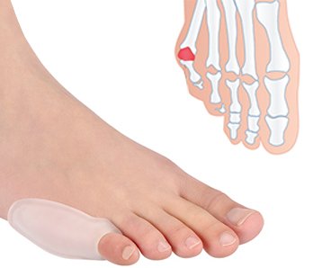 serçe parmak silikon bunyon koruyucu