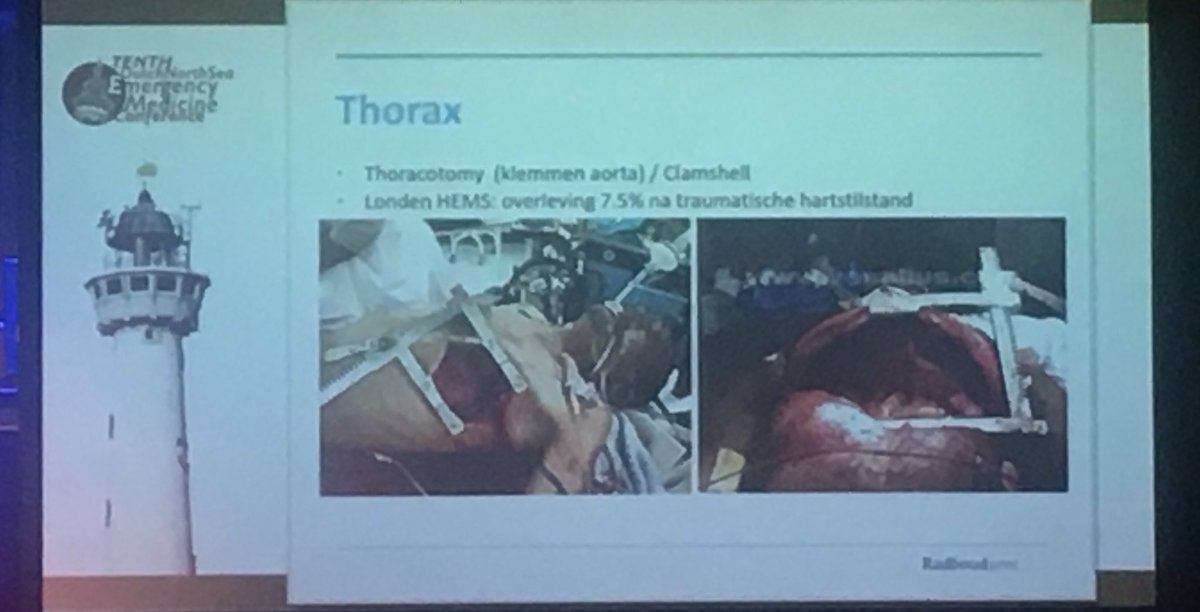 maikberendsen's tweet photo. Stop the bleeding in trauma: Tourniquets (junctional), reboa, CO2 insufflator, thoracotomy and foley catheters by @ecthtan #DEMC17 https://t.co/me5TnOjgcp