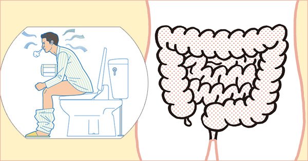 日経gooday Ar Twitter あなたの腸は老化していない 絶好 腸 度をチェック 10年前と比べて便通の調子が変わっている たくさん食べても太らない 最近グウーっとおなかが鳴るほど空腹感を感じない あなたはいくつ当てはまる 便秘 T Co