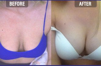 GeoHeathTips's tweet photo. #health #beauty #fitness how to make your #breast bigger naturally with massage
https://t.co/Llg5vFL8Cw https://t.co/ozw206LxVZ