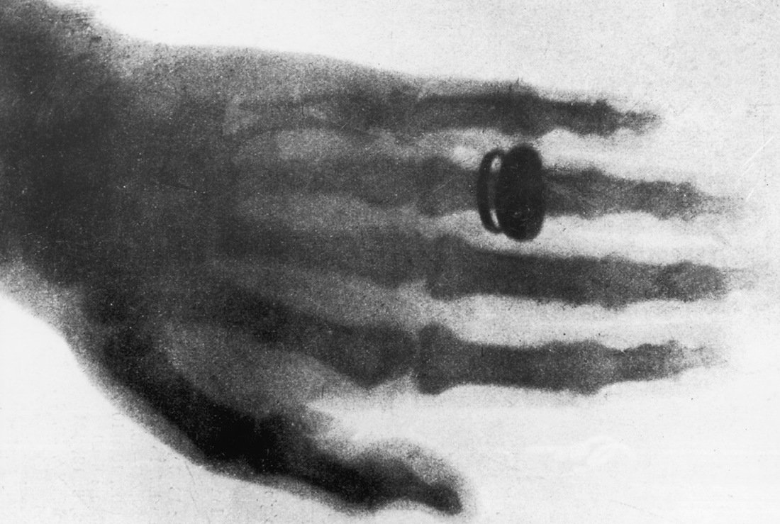 #WednesdayWisdom: did you know that X-Rays were first discovered in 1895 #xrays #science tinyurl.com/pm9ndef