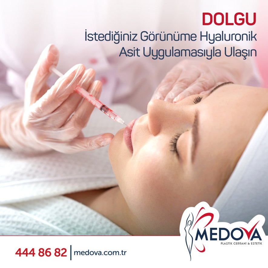 Dolgu ile ilgili bilgi ve randevu için: 0 332 223 05 47
#medovahastanesi #medovaestetik #dolgu #güzelyaşam #sağlıklıyaşam