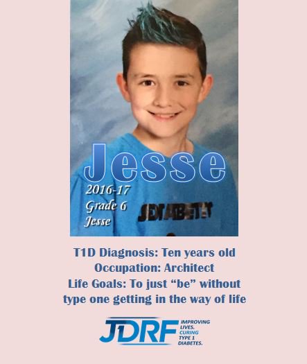 JDRFEdmonton's tweet photo. Let's find a cure for Jesse and everyone living with T1D. Check out https://t.co/sjDdmTjUN6 and #TELUSWalk #JDRF https://t.co/SeNeHnI72C