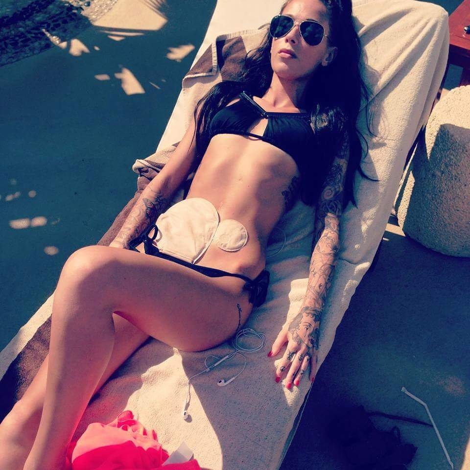 CrohnsColitisUK's tweet photo. It's been 3 years since we posted THAT pic - 12.6 million views &amp; 246k likes! THANK YOU @BethyTownsend 💜 #Stoma #Crohns #IBD https://t.co/MbTjyPqHfT