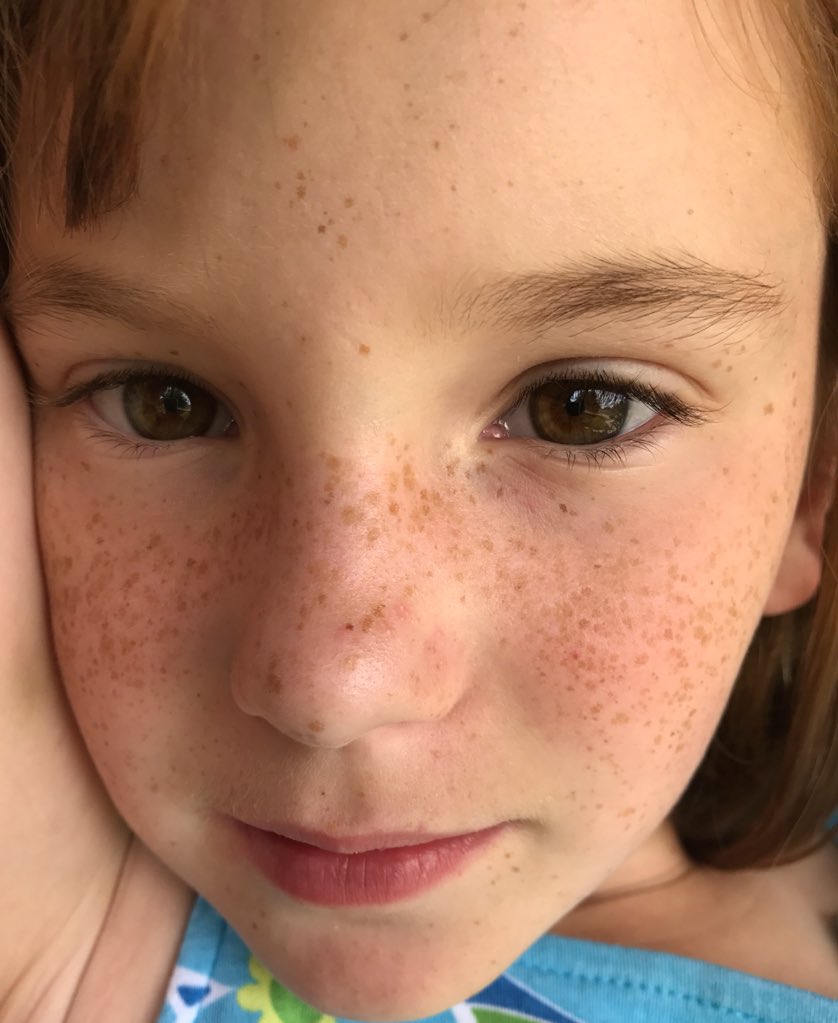 sralee300's tweet photo. #thosefreckles https://t.co/xieCBOBlqp