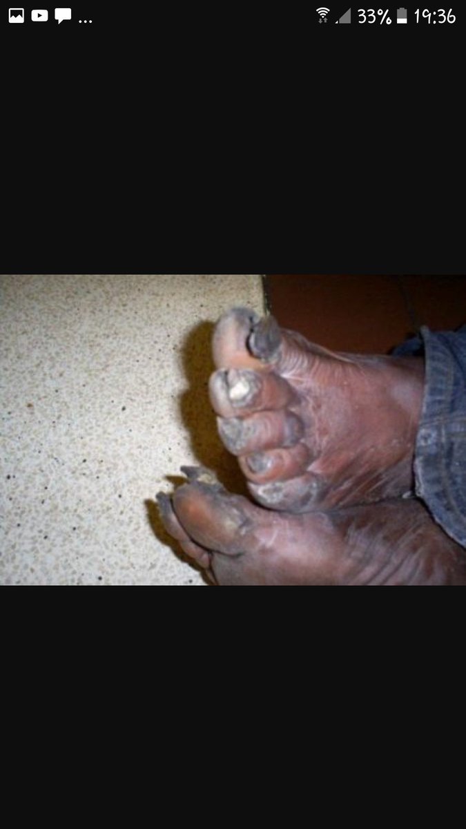 4damrich84's tweet photo. @StevoTheMadMan yes niges  toes 😂 https://t.co/hTX08ctoXl