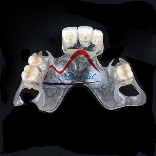 MegaDentalLabs's tweet photo. #ClearFlexiblPartialRemovableDenture #removabledenture https://t.co/eegcT9Cwrq https://t.co/I4TVdzJepe
