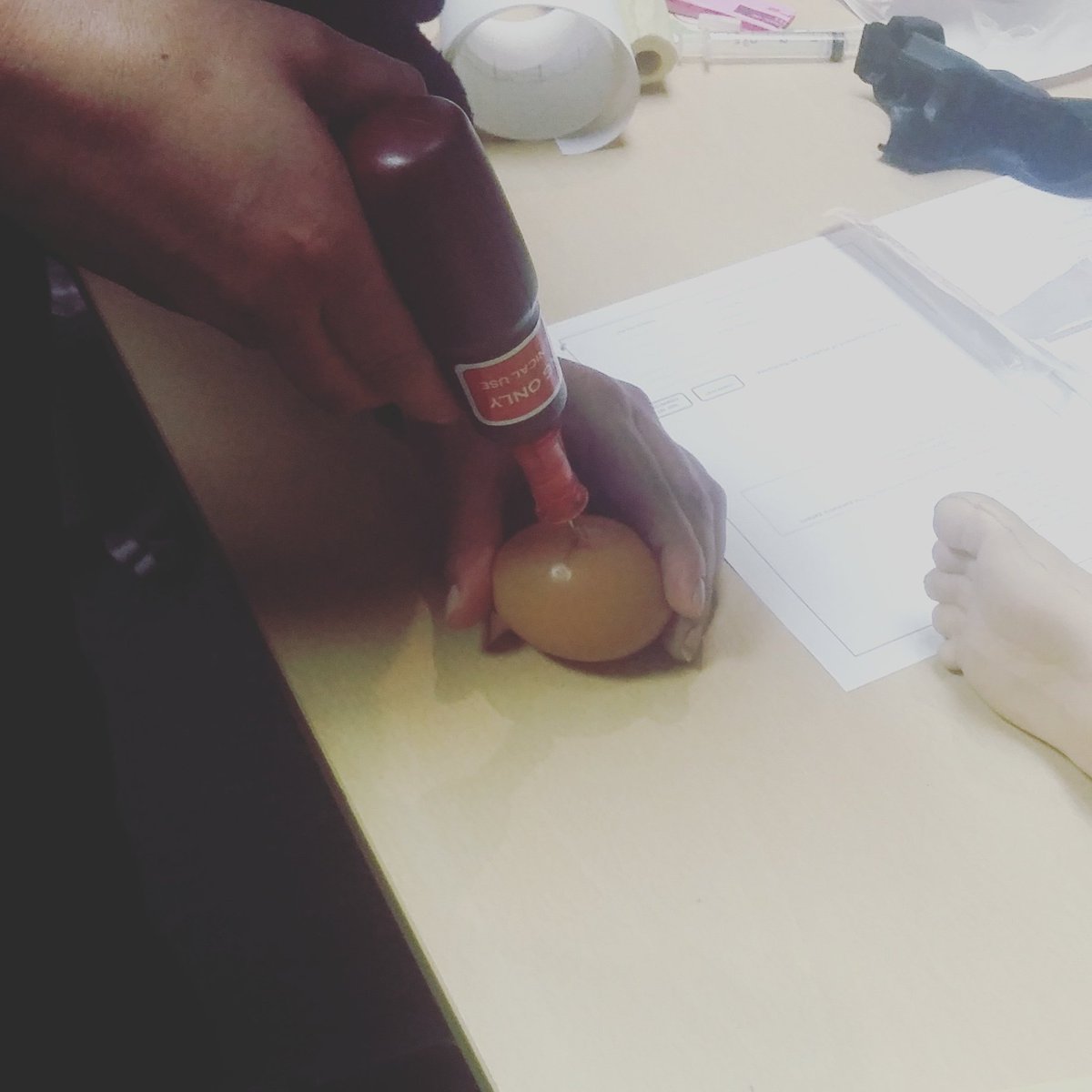 chrysjbent's tweet photo. IO Insertion Practice on an Egg #DipEMC #IOpractice #student https://t.co/7Q8nDlMSmc