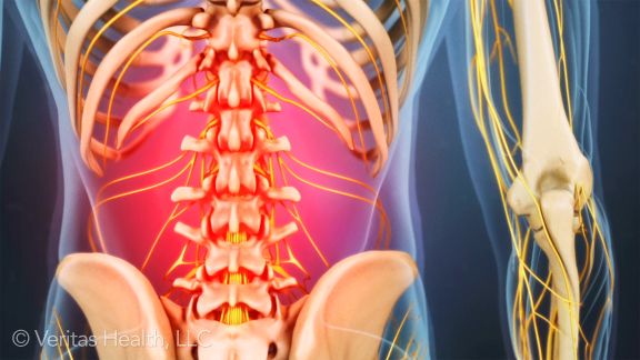 Spine2024's tweet photo. #Exercise_therapy #research gives improved outcomes in #spinalcordinjury
More @spine2017
#Neuroscience #spine #SCI #Neurosurgery #neuro https://t.co/ywOmTRCRXc