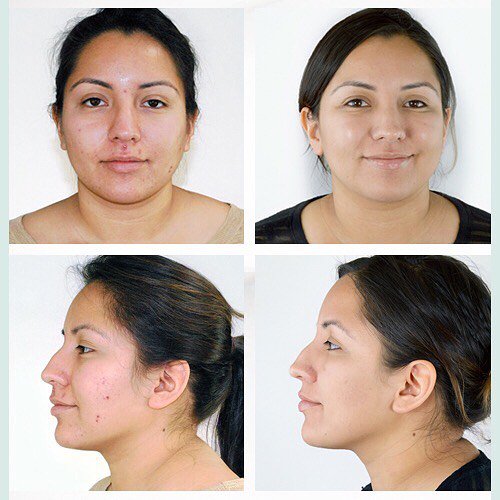 _skinlogic's tweet photo. Get amazing results with our chemical peels range #glotherapeutics #glominerals https://t.co/Pz6pxiDzoC