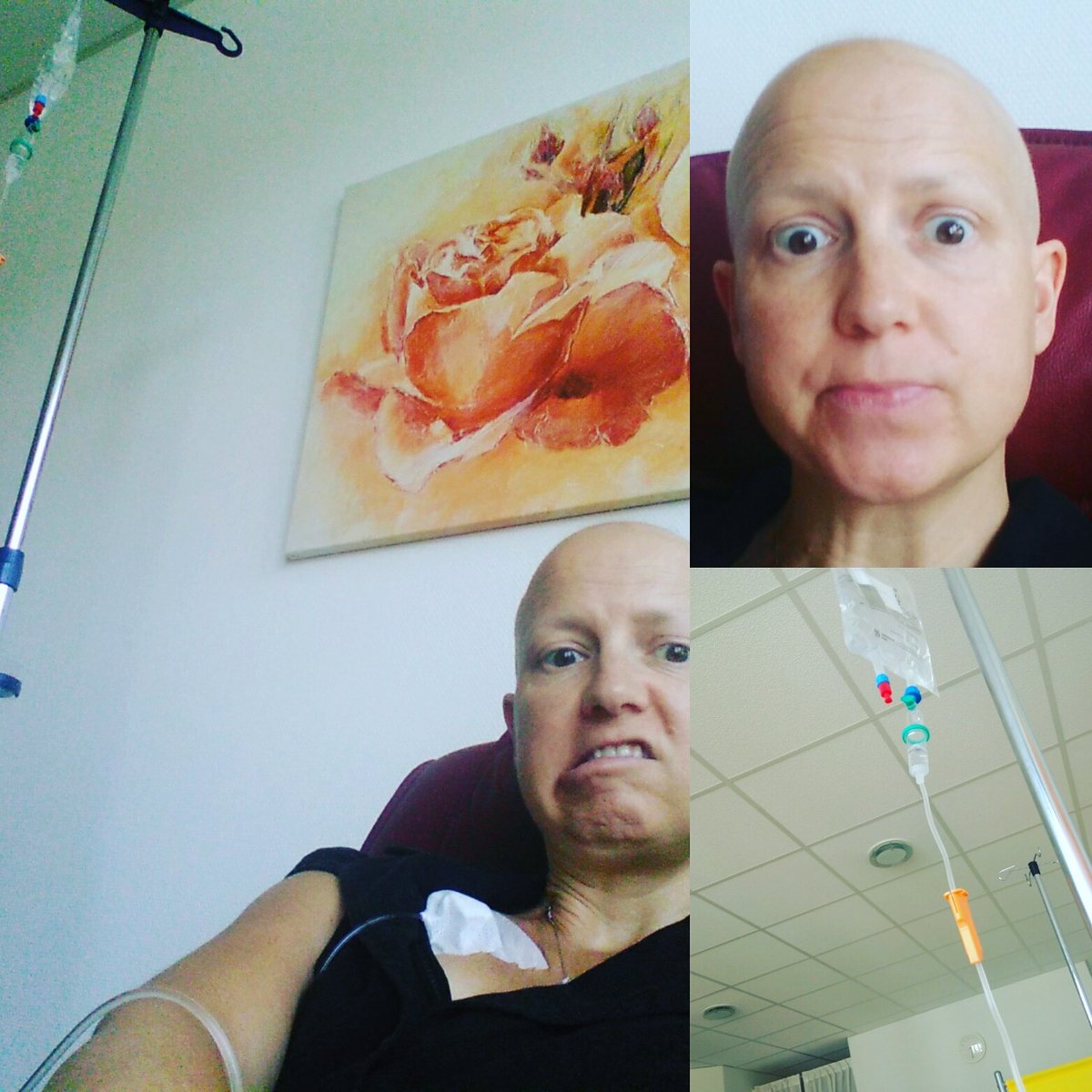 beriyani's tweet photo. @CLIC_Sargent Hats (and hair) off to support #nofilter4cancer We know #cancersucks #chemosucks but #baldisbeautiful https://t.co/HCXChB6MWo https://t.co/tuNo75Ty5a
