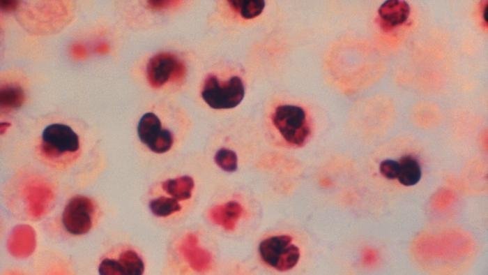 WESH's tweet photo. 2 guests contract Legionnaires' disease at Las Vegas hotel https://t.co/PCgls0Mprc https://t.co/CnyW38ITMJ