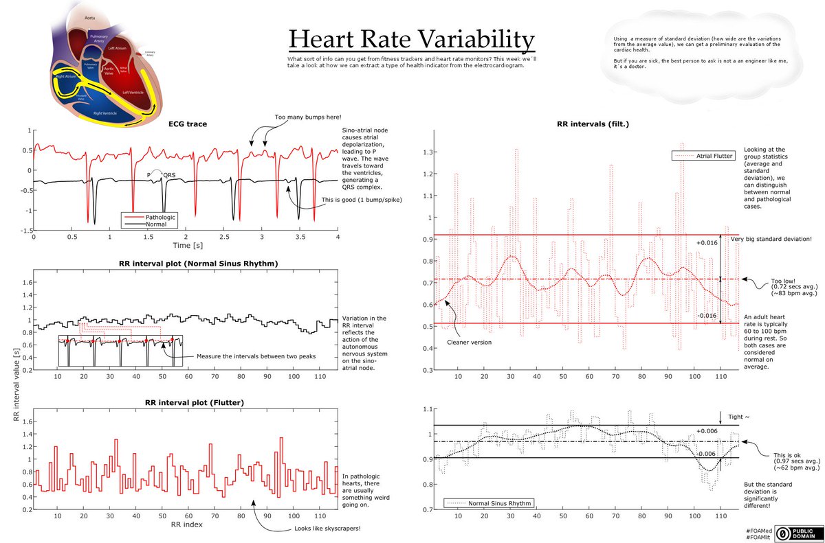 KaiserHaz's tweet photo. Week 1: Looking at Heart Rate Variability and how it may be possible to do pre-assessment of cardiac health. #FOAMlit #FOAMed. https://t.co/wyCI8N6XNw