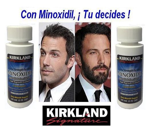 MinoxidilVzla's tweet photo. #MinoxidilVenezuela #MinoxidilCaracas
#MinoxidilCCS #CreceBarba #BeardVenezuela
#BarbasVenezuela #BarbasLargas #Barbudos
#Beard https://t.co/reqZs4B63x