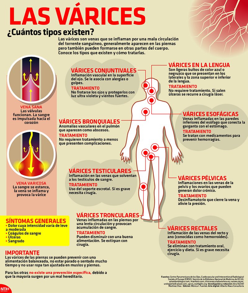 consentidocdmx's tweet photo. #Salud | "Para prevenir los #ProblemasCirculatorios venosos se recomienda la movilidad; la caminata y natación, la opción": Dra. Ely Morán. https://t.co/qIyojrQfE3
